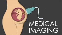 The most popular types of MEDICAL IMAGING techniques Instructional Video