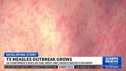 Measles outbreak in Texas grows to 58 cases News Clip