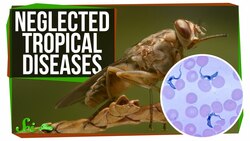 3 Deadly Diseases You've Probably Never Heard Of Instructional Video