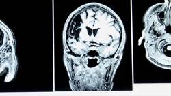 The Stroop Effect: How Your Brain Interprets Colors Instructional Video