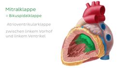 Mitralklappe Instructional Video
