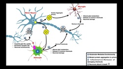 Amyotrophic Lateral Sclerosis [ALS] | Mechanism of Neuron Death Instructional Video