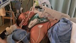 A Mississauga firefighter's survival story News Clip