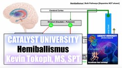Hemiballismus | Pathogenesis, Signs/Symptoms, and Detailed Mechanism Instructional Video