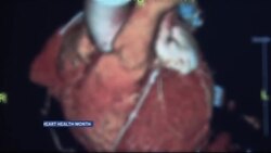 Raising awareness for women's heart health during American Heart Month News Clip