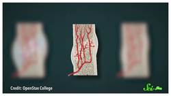 Are Broken Bones Stronger After They Heal? Instructional Video