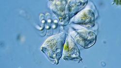 The Schoolteacher Who Discovered 700 Ciliates Instructional Video