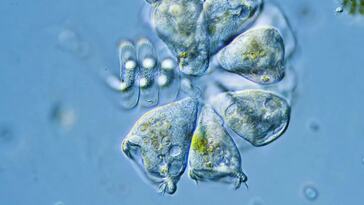 The Schoolteacher Who Discovered 700 Ciliates