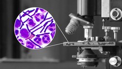 Sulfa Drugs Instructional Video