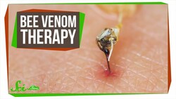 The Problem with Bee Venom Therapy Instructional Video