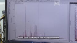 Researchers in the UK are trialling a breath test for early detection of cancer News Clip