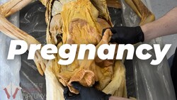 What Pregnancy Does to the Body Instructional Video