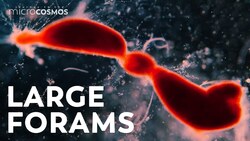 Why Are These Single-Celled Organisms So Large? Instructional Video