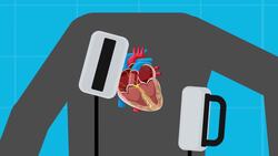 Can You Actually Shock Someone Back To Life Instructional Video