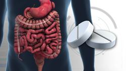 Antibiotics could be used to treat patients with appendicitis Instructional Video