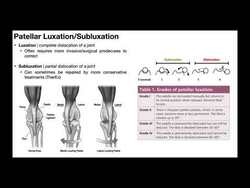 TherEx | Patellar Stabilization Series [Part 1] | Subluxation vs Dislocation Instructional Video