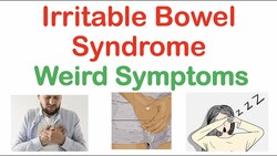 Weird Symptoms of Irritable Bowel Syndrome | Atypical Clinical Features of IBS Instructional Video