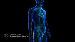 Study finds link between cannabis use and heart attacks in young people News Clip