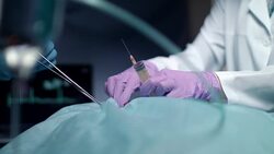 Surgeon operating process. Surgeon hands holding surgical tools Stock Footage