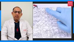 International Epilepsy Day: Debunking common myths around epilepsy News Clip