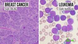 A Vaccine Against ... Cancer? Instructional Video