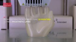 3D printing prosthetic limbs for refugees Instructional Video
