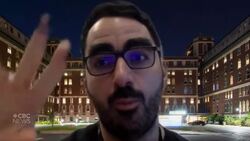 Dr. Robert Fahed on how he performs brain surgery without incisions News Clip