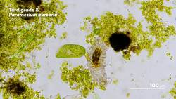 How to Identify Microbes Instructional Video