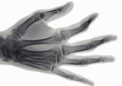 Dolores del crecimiento Instructional Video