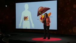 TED: Good news in the fight against pancreatic cancer | Laura Indolfi Instructional Video