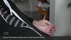 Horrific ER bedsore leads quadriplegic man to seek assisted death News Clip