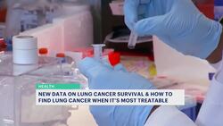 Tech advancements, new treatments fuel spike in lung cancer survival rates News Clip