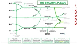 Diagnosing Nerve Damage with EMG [Example 2] | UE, Distal to Elbow Instructional Video