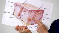 Acne Cyst vs. Pimple Instructional Video