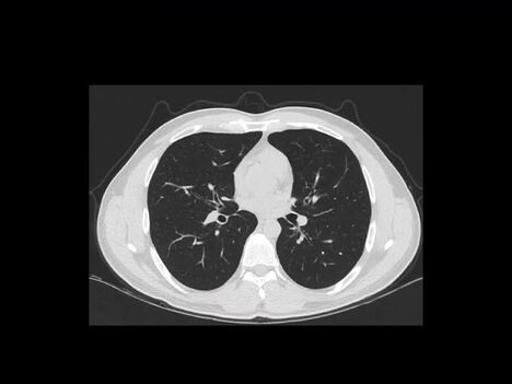 Anatomy of CT scans: Introduction