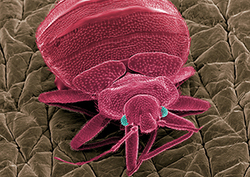 What is a microorganism? Instructional Video