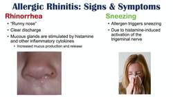 Allergic Rhinitis (Hay Fever & Seasonal Allergies) Signs & Symptoms (& Why They Occur) Instructional Video