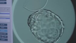 Yale doctors: Ovarian tissue freezing could prevent menopause News Clip