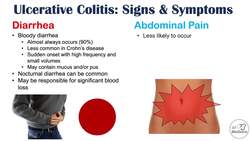 Ulcerative Colitis Signs and Symptoms (& Why They Occur), and Complications Instructional Video