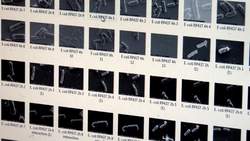 Researchers tackle dangerous, but poorly understood biofilms - Science Nation Instructional Video