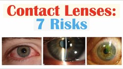 7 Risks of Contact Lens Use | Eye Infections, Disease and Complications from Contact Lenses Instructional Video