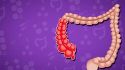 I WONDER - What Are The Different Parts Of The Colon? Instructional Video