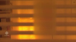 Plastic surgery fake? News Clip