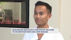 ‘Now he literally has a part of me.’ Brother donates part of his liver to twin News Clip