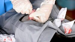 Vet doing the operation for sterilization. The cat on the operating table in a local clinic. Cat in a veterinary surgery , Stock Footage