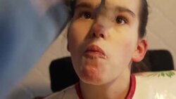 CLEAN : France trials CBD medical cannabis to treat epileptic children News Clip