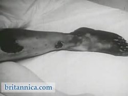 Tobacco and the Human Body - Part 2 Instructional Video