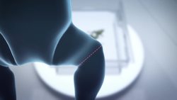 Hormone boosts regeneration of amputated limbs in frogs Instructional Video