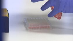 Scientist working with samples in a lab to test coronavirus treatments News Clip