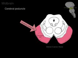 Foundational features of the brainstem Instructional Video